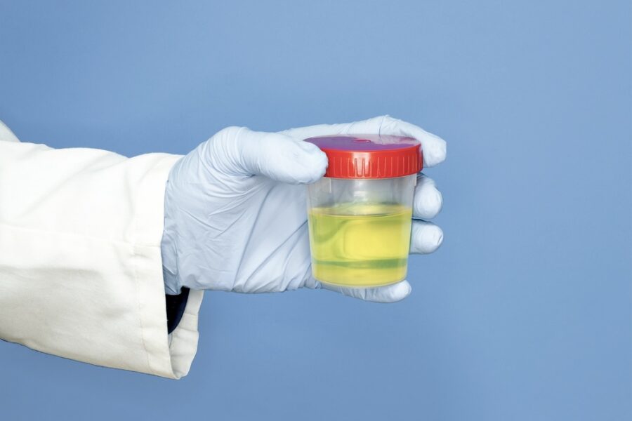 Medical staff holding a urine sample for a drug test