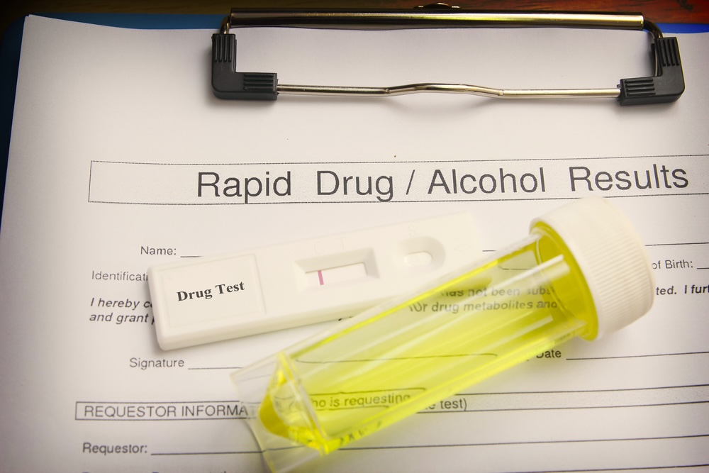 Meth drug test result form document with urine sample in small vial