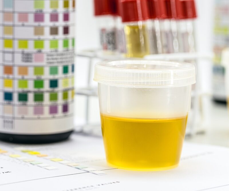 Plastic container of urine test for crack cocaine drug test